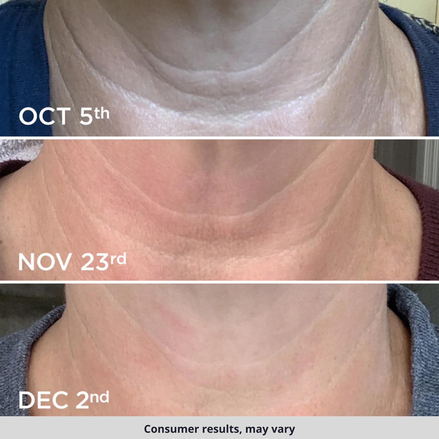 TIGHTEN & LIFT NECK CREAM