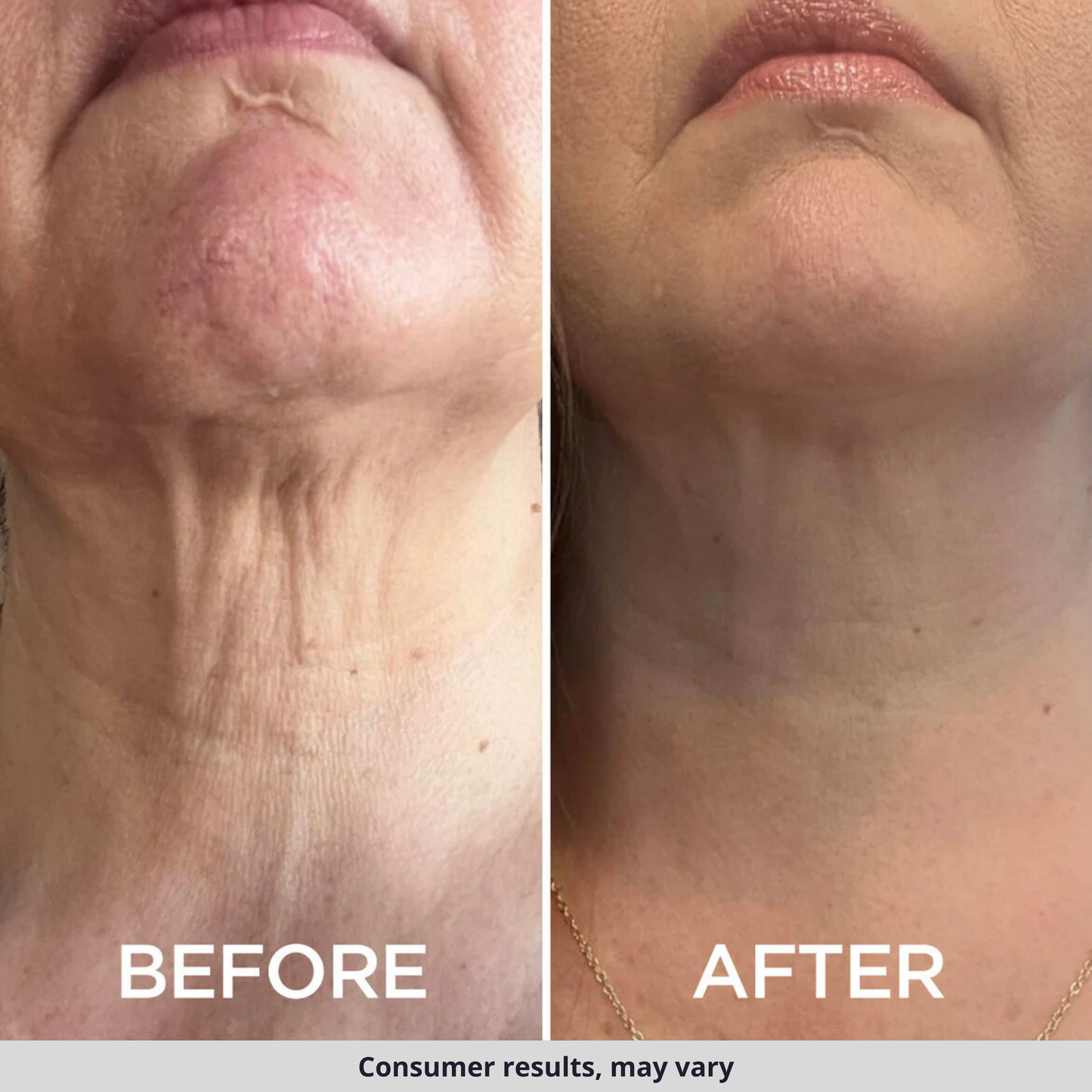 TIGHTEN & LIFT NECK CREAM